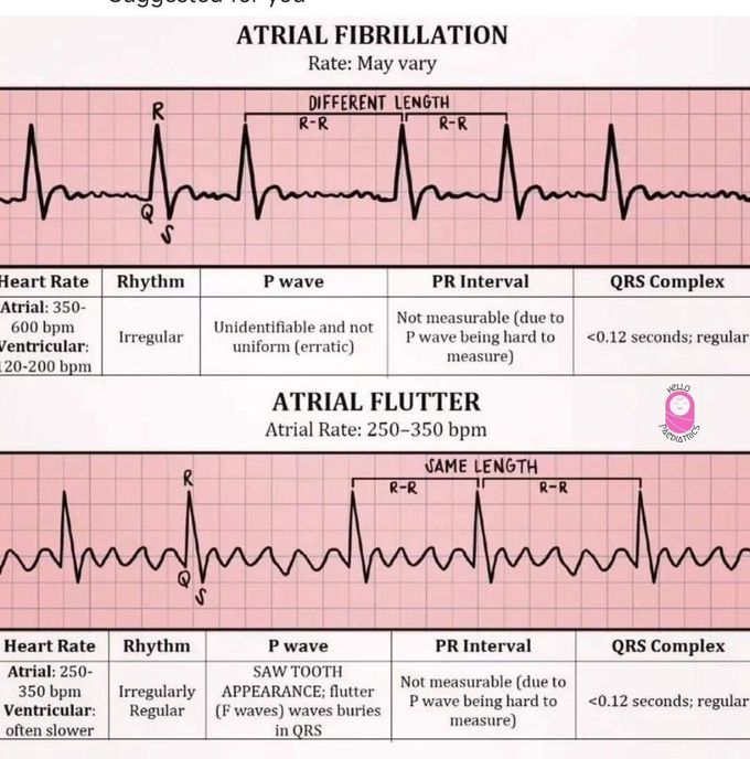 ECG Review