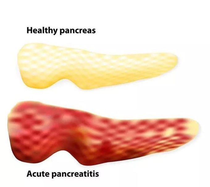 Pancreas