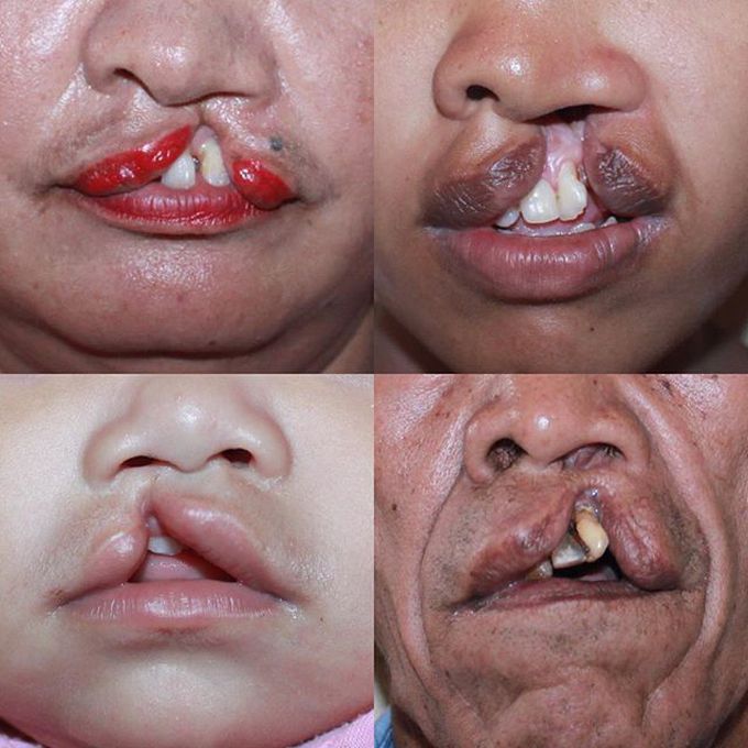 Can you answer the diagnosis properly ? 