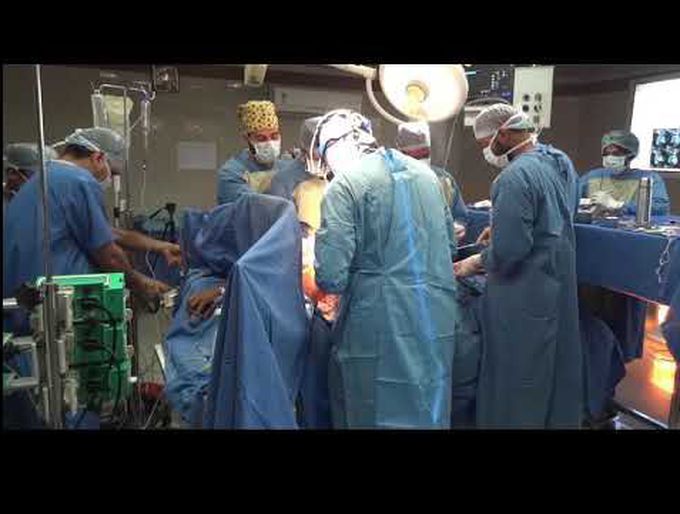 Three-Dimensional Printing-Guided Precise Surgery for Complex Pulmonary Arteriovenous Malformation