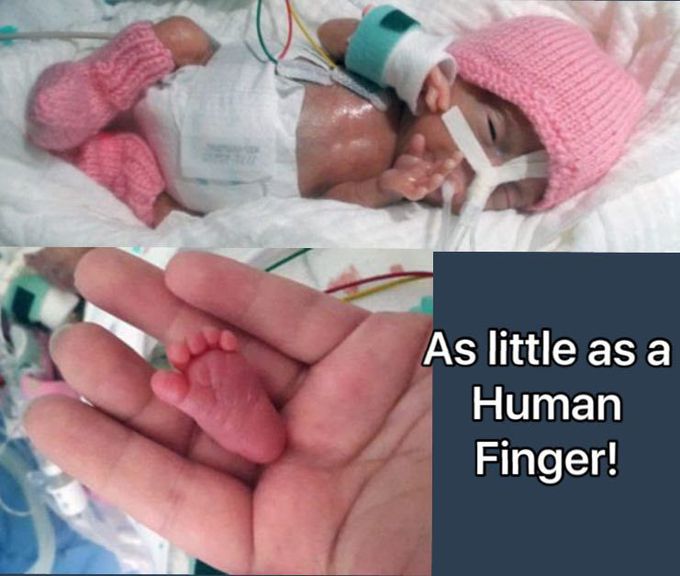 8 ounces baby world's smallest baby