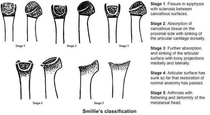 Smillie's classification