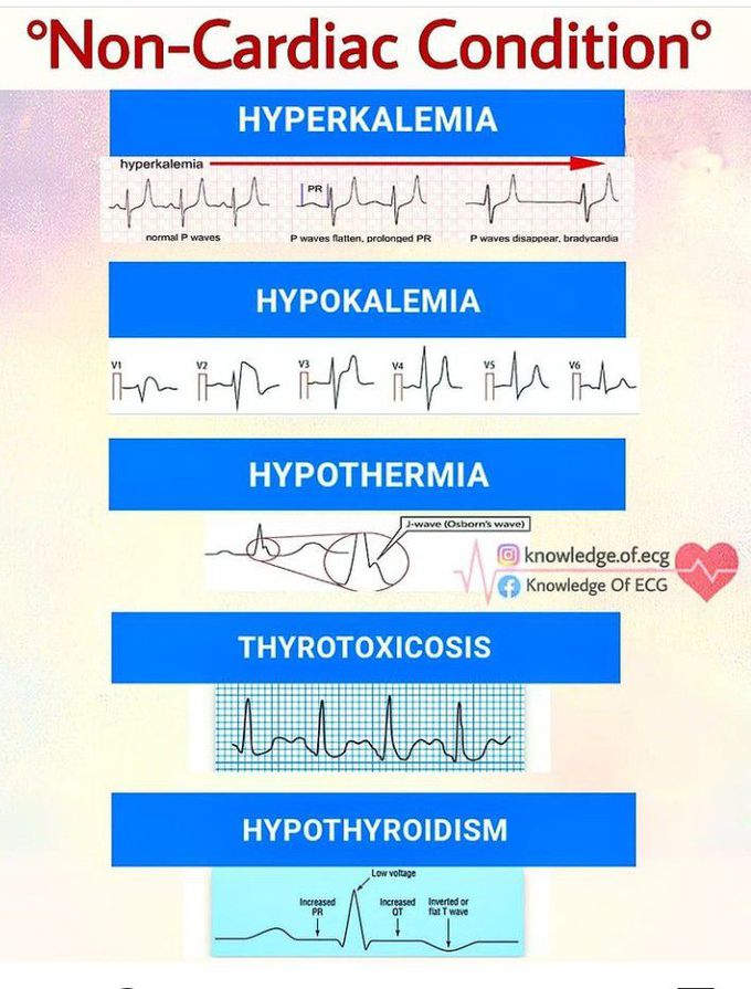 Non cardiac conditions