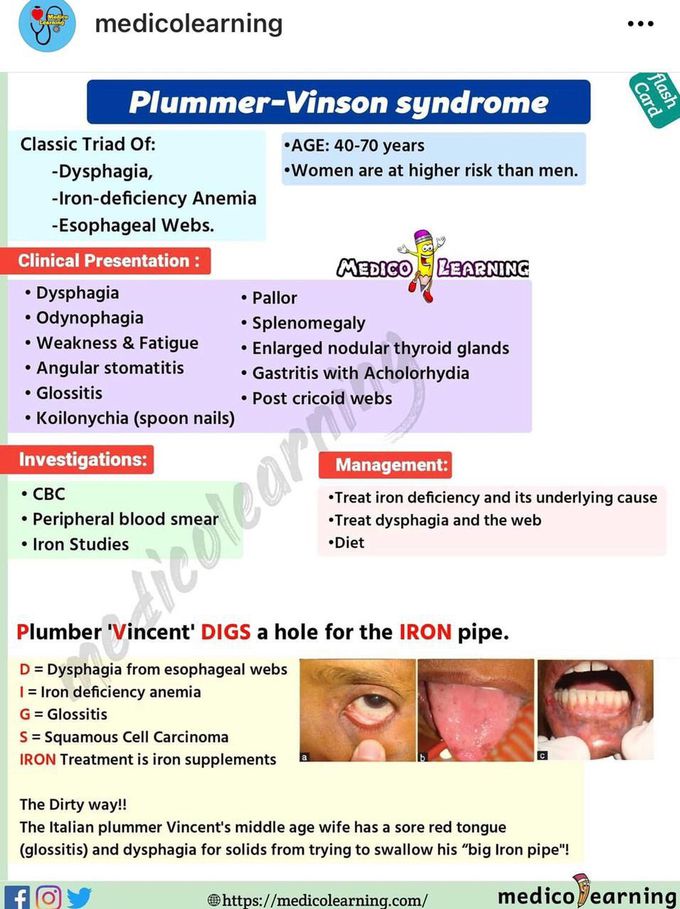 Plummer vinson syndrome