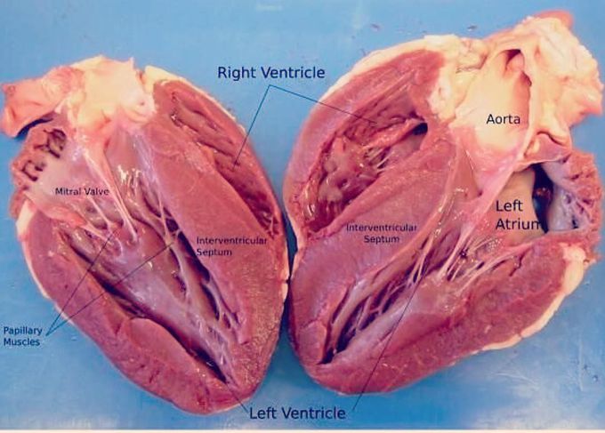 Labeled heart!
