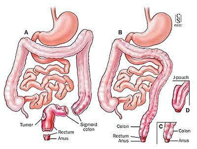 Surgery