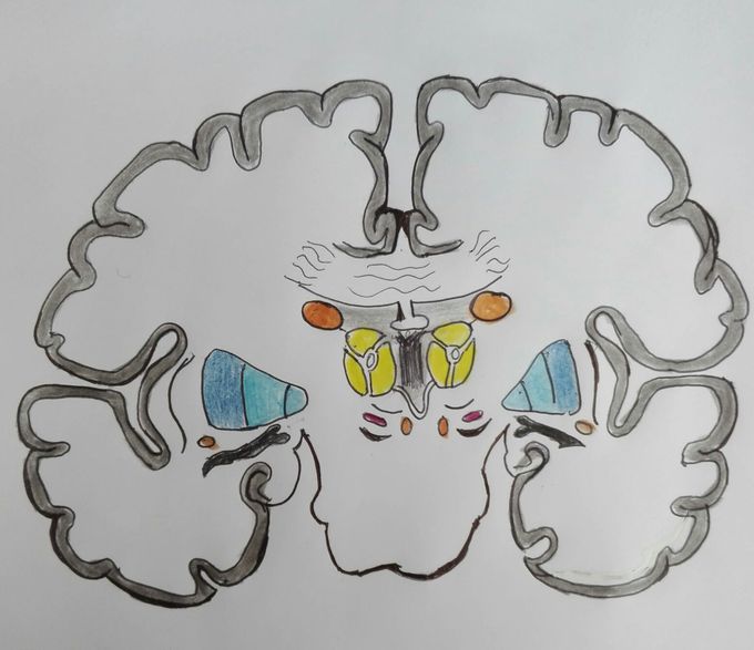 Brain: Coronal cut ❤