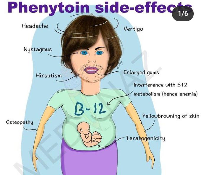 Phenytoin side effects