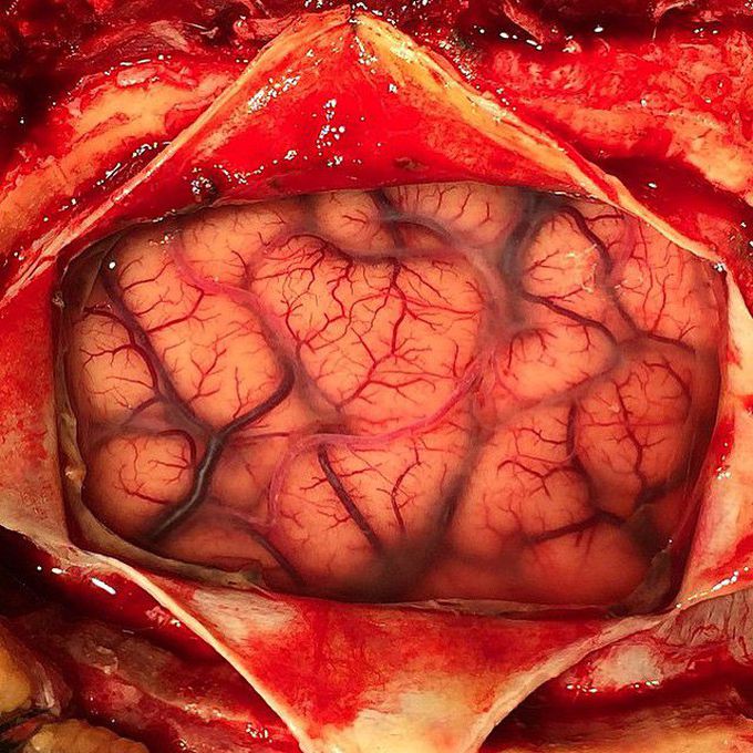 An incredible close-up shot of a living human brain