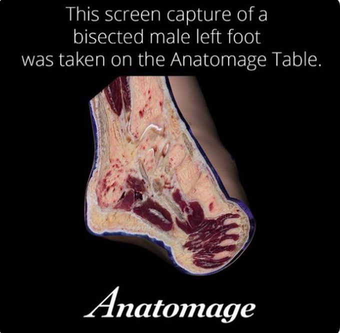 Anatomy