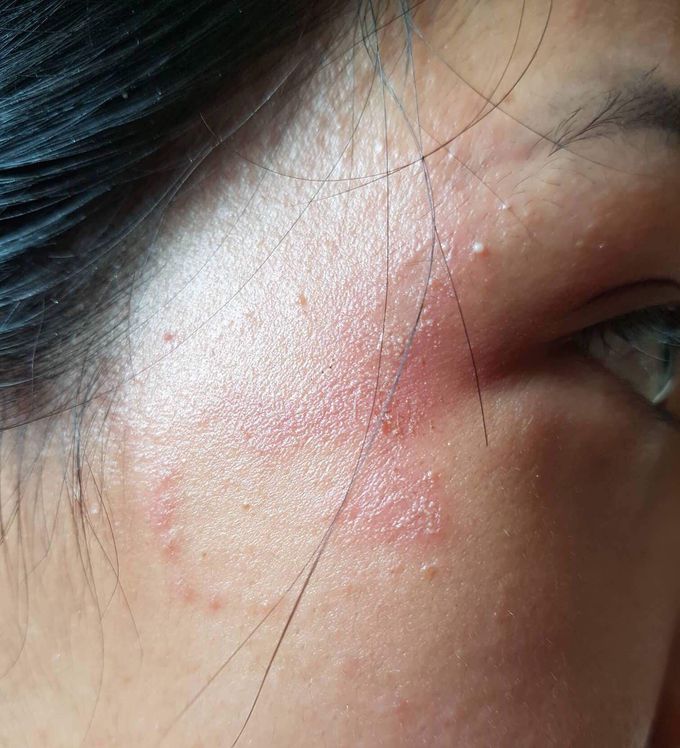 What is your diagnosis? I need help