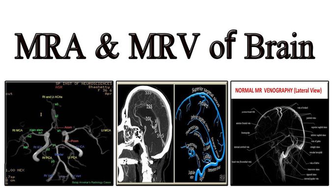 MRA and MRV