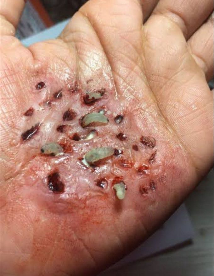Name the infestation