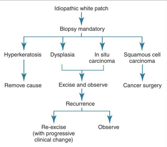 Idiopathic leukoplakia