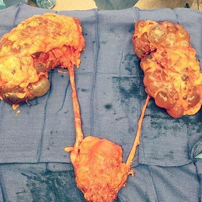 A unique shot of a dissected urinary system