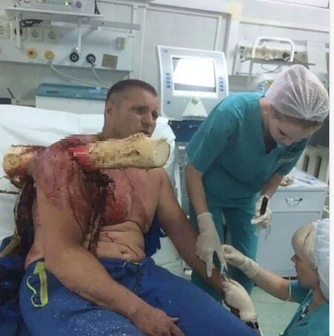 general trauma surgery