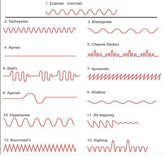 Type of respiraton