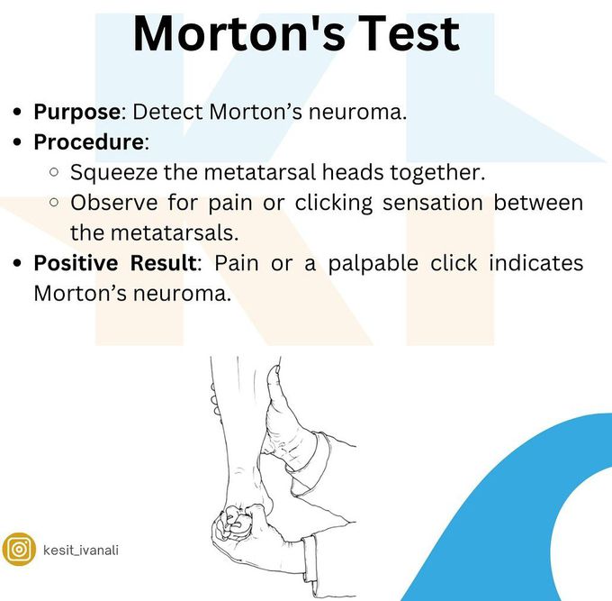 Morton's Test