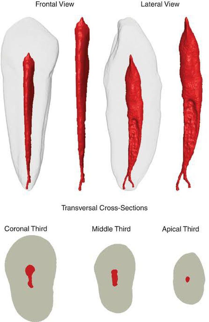 Maxillary canine root