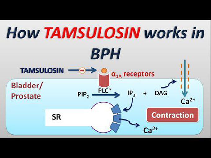 Benign Prostatic Hyperplasia -Tamsulosin-II