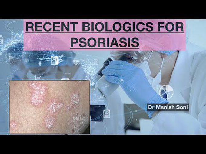 Biological Treatment of Psoriasis