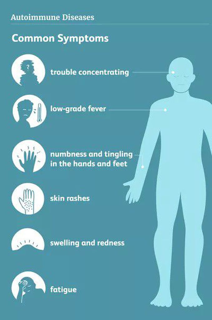 These are the main symptoms of Autoimmune syndrome