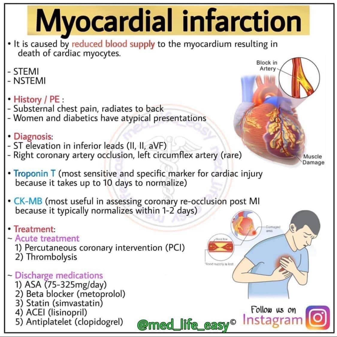 Anterior Myocardial Infarction Of Indeterminate Age