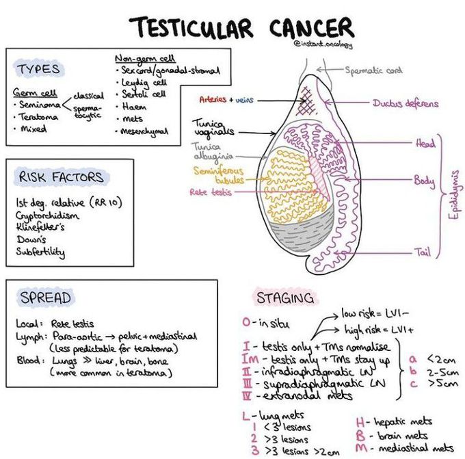 Testicular Cancer