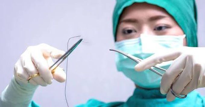 Sutures. What are the types of sutures?  Suture techniques