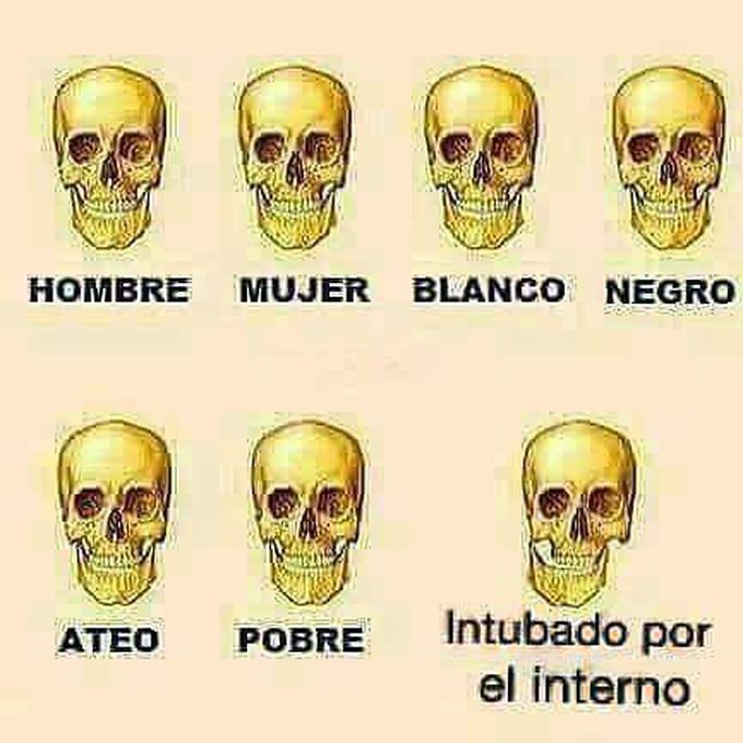 XD