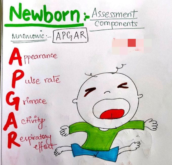 APGAR SCORE