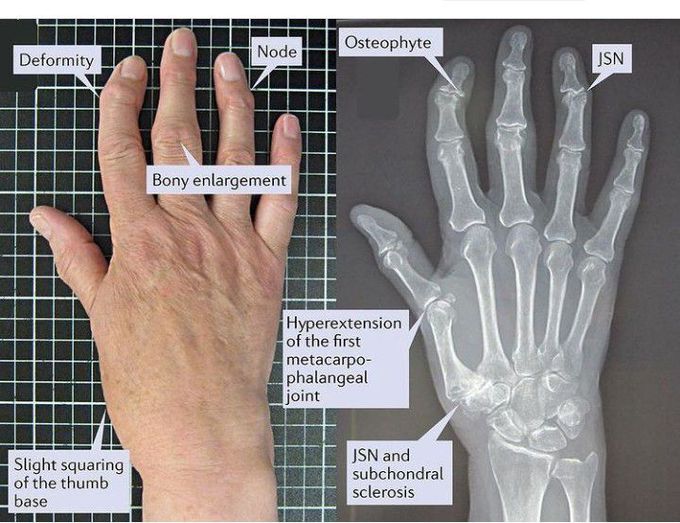 Identify the pathology