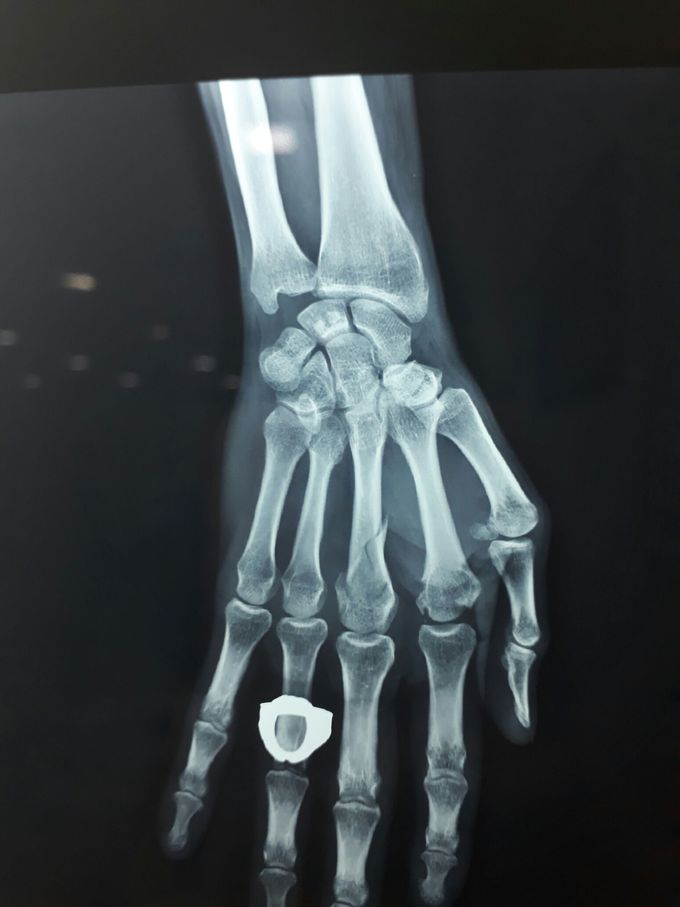 Orhopedic case
