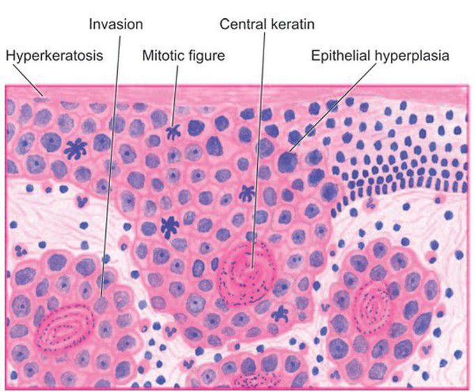 Oral mucosa