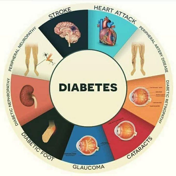 Diabetes common symptoms