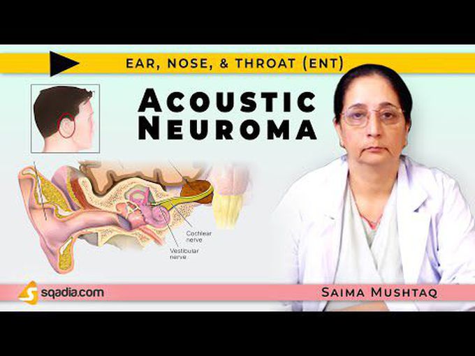 Acoustin Neuroma/Vestibular Schwannoma