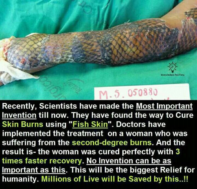 Latest  research  for skin  burns