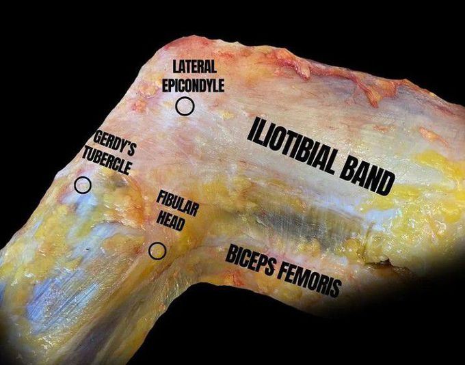 Specimen of Iliotibial Band (ITB)