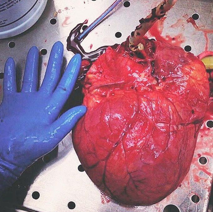 The Big Heart