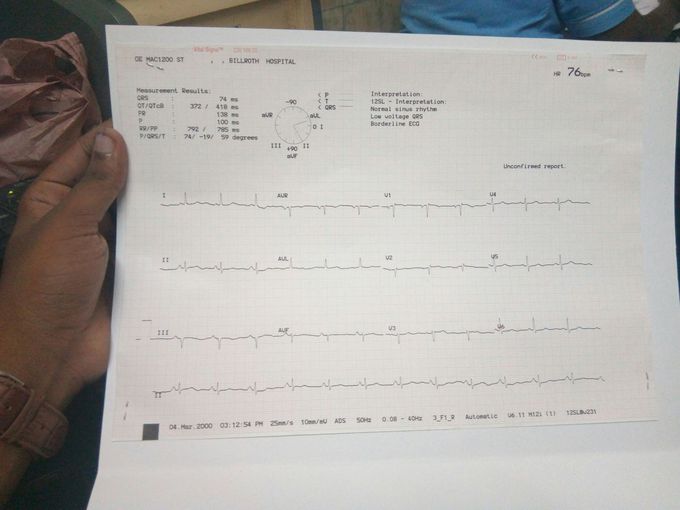 Diagnosis ?