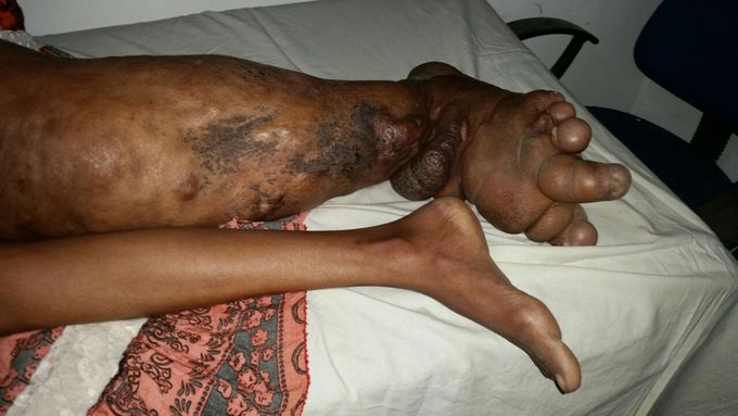 Giant leg