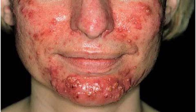 Diagnose??