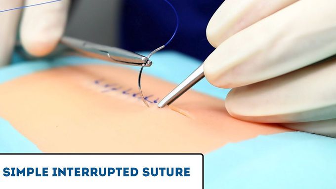Simple Interrupted Suture-Complete Guide