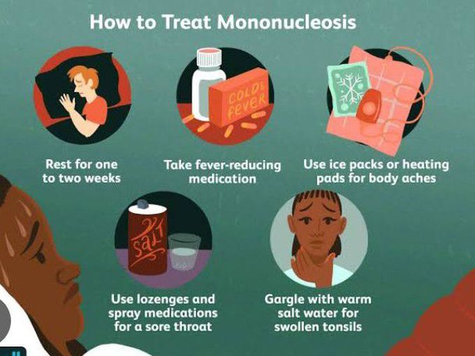 Treatment for Mononucleosis