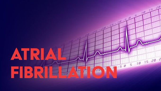 Atrial Fibrillation