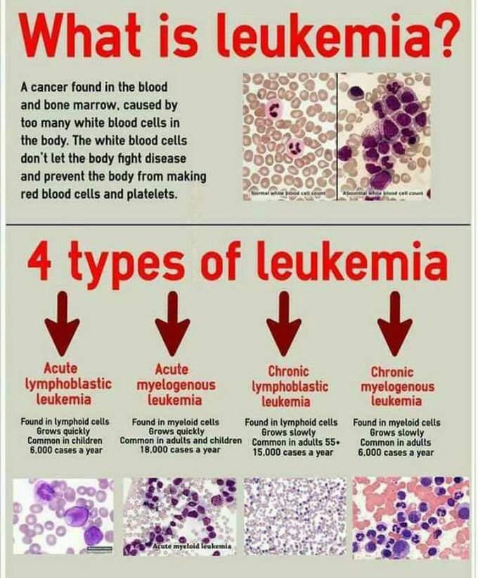 Blood cancer