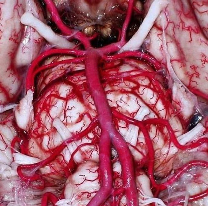 Circle of Willis