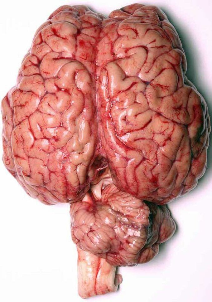 FRESH BRAIN 🧠