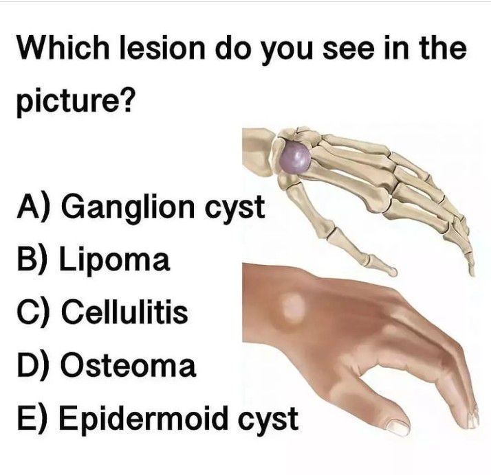 Identify the Lesion - MEDizzy