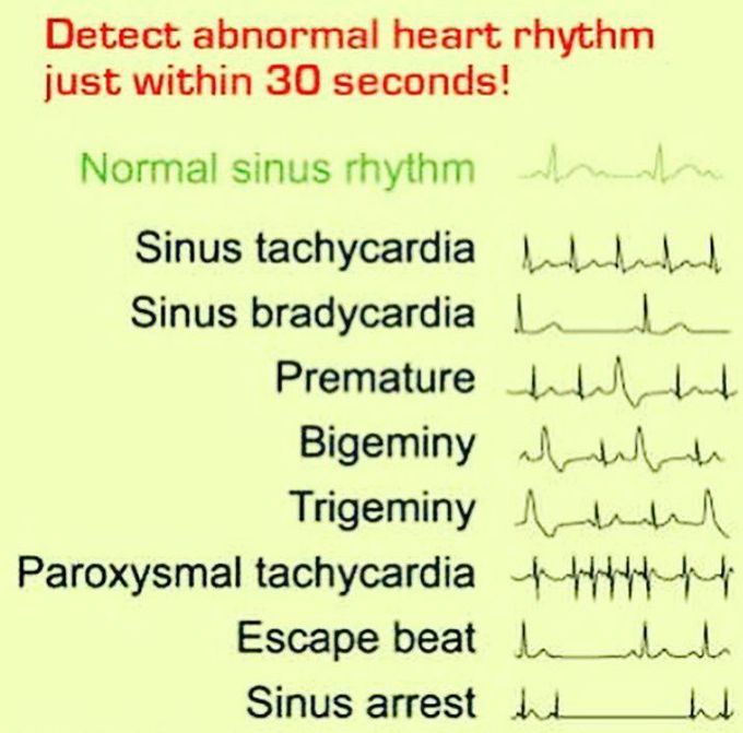 Heart_rhythm